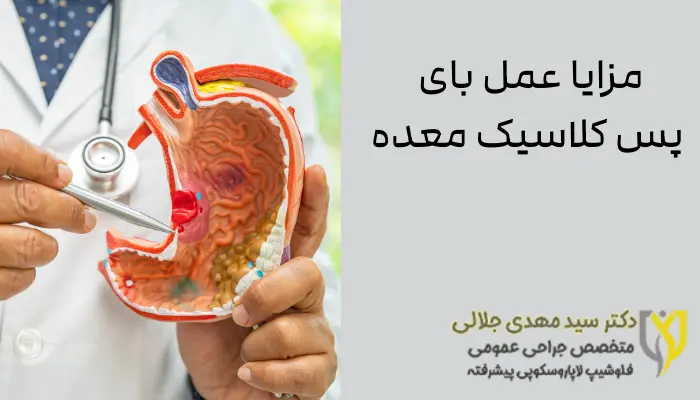 مزایا عمل بای پس کلاسیک معده