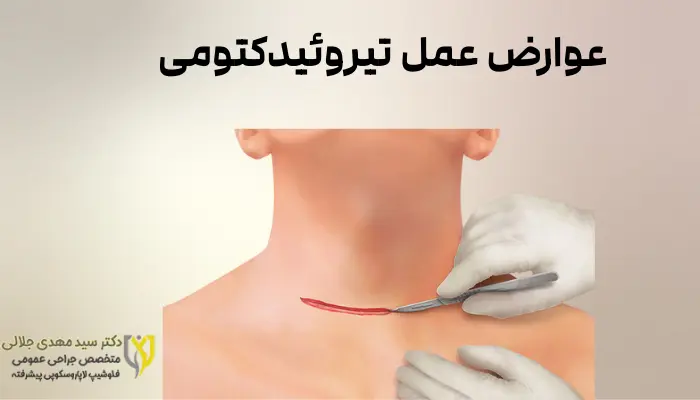 عوارض عمل تیروئیدکتومی