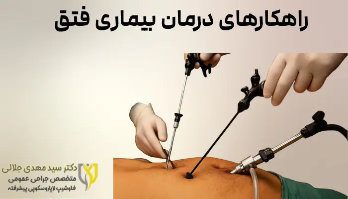راهکارهای درمان بیماری فتق