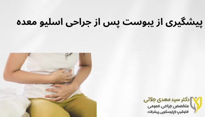 پیشگیری از یبوست پس از جراحی اسلیو معده پیشگیری از یبوست پس از جراحی اسلیو معده