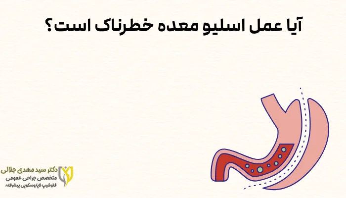 آیا عمل اسلیو معده خطرناک است؟