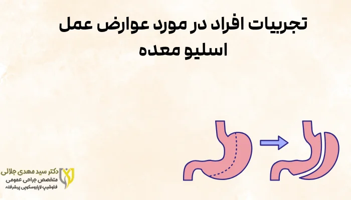 تجربیات افراد در مورد عوارض عمل اسلیو معده