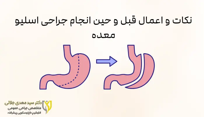 نکات و اعمال قبل و حین انجام جراحی اسلیو معده نکات و اعمال قبل و حین انجام جراحی اسلیو معده
