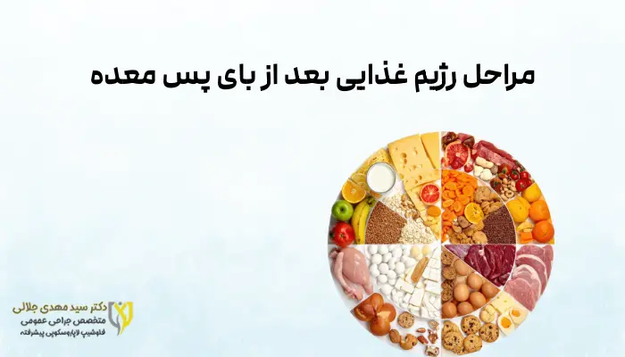 مراحل رژیم غذایی بعد از بای پس معده