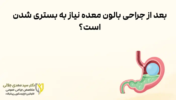 بعد از جراحی بالون معده نیاز به بستری شدن است؟
