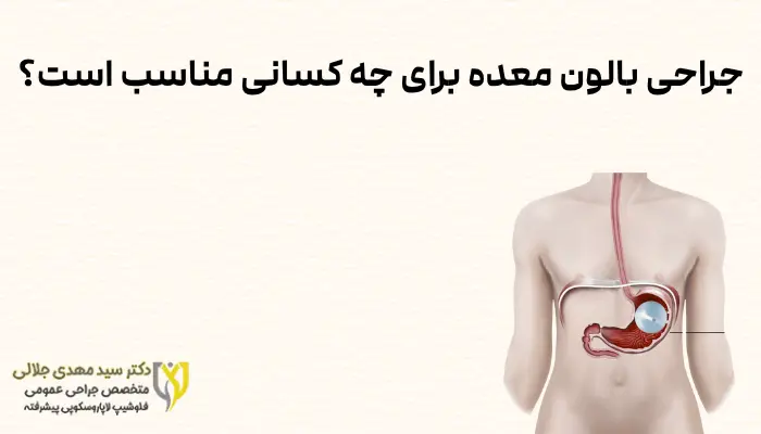 جراحی بالون معده برای چه کسانی مناسب است؟