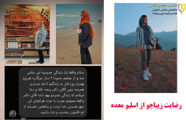 رضایت زیباجو از اسلیو معده