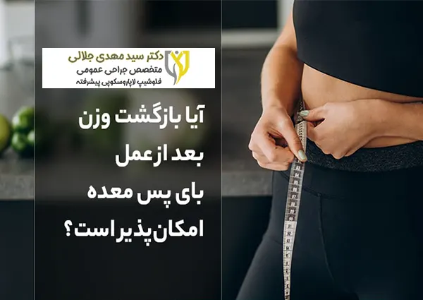 بازگشت وزن بعد از بای پس معده