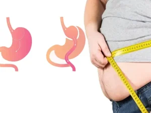 برگشت نتیجه عمل بای پس