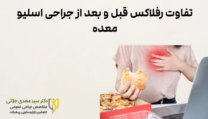 تفاوت رفلاکس قبل و بعد از جراحی اسلیو معده