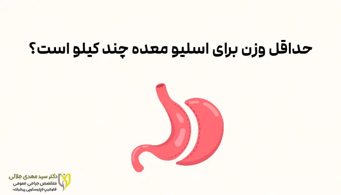 حداقل وزن برای اسلیو معده چند کیلو است؟