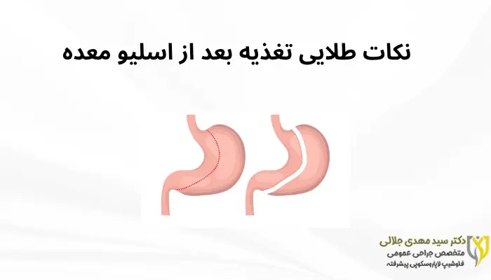 نکات طلایی تغذیه بعد از اسلیو معده نکات طلایی تغذیه بعد از اسلیو معده